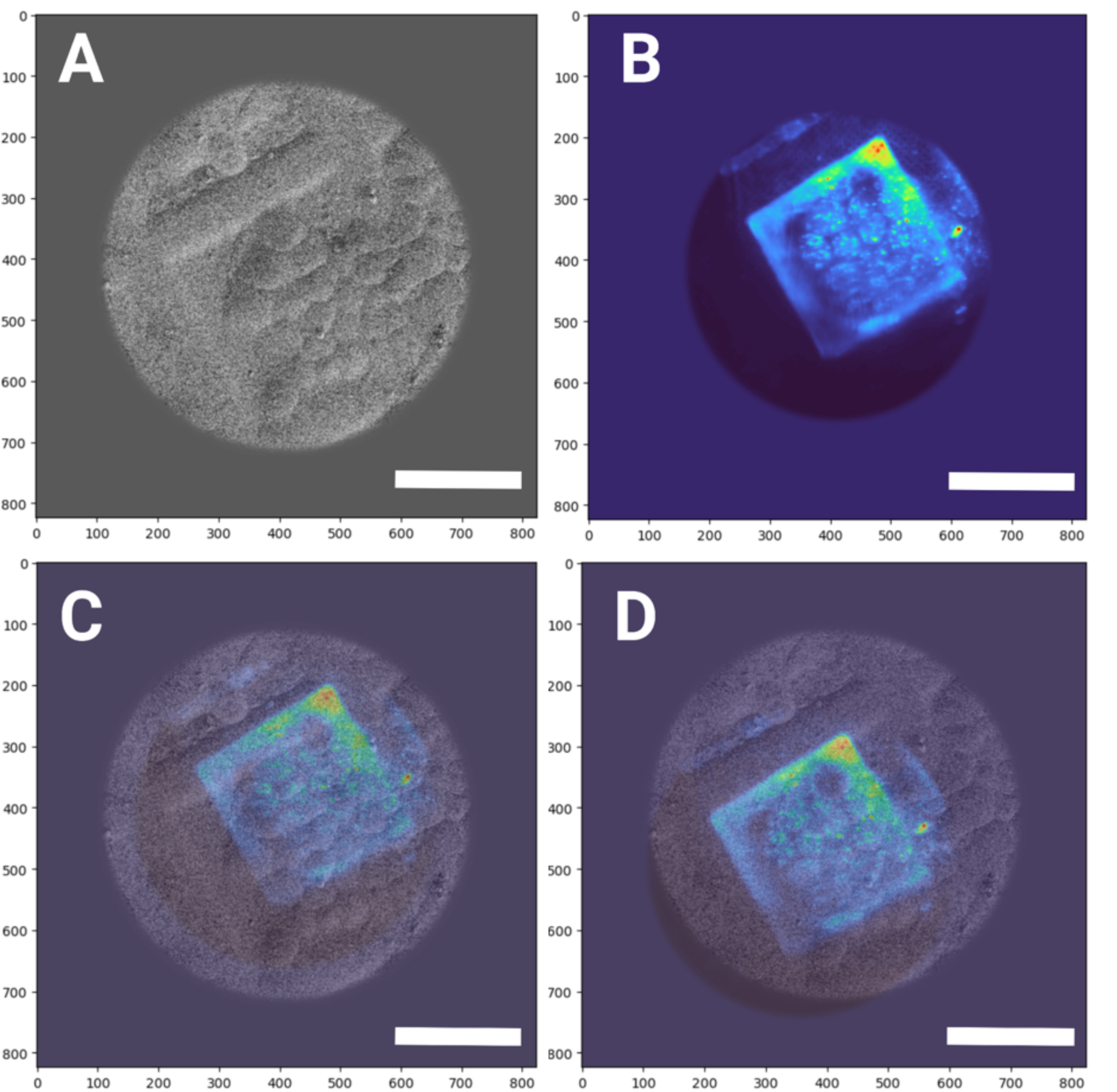 GitHub - Phaips/xcorr: Cryo-correlative microscopy