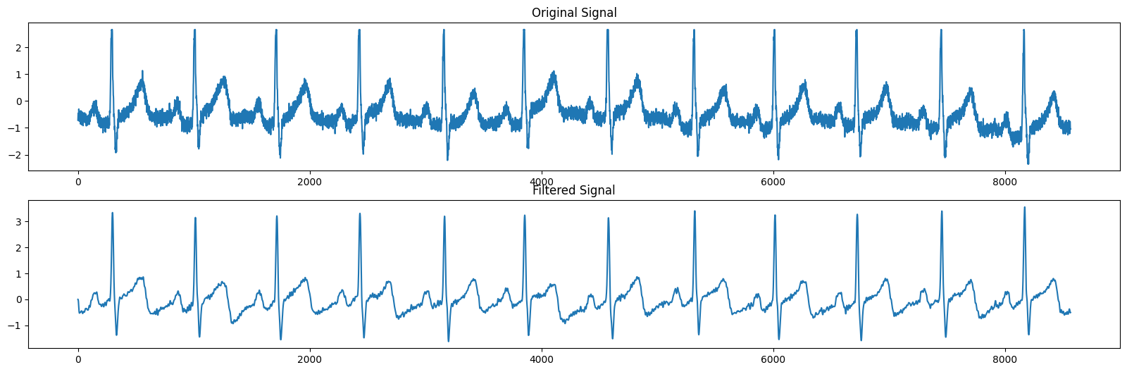 GitHub Pahansith7/ECG_Arrythmia_Detection This is a project I
