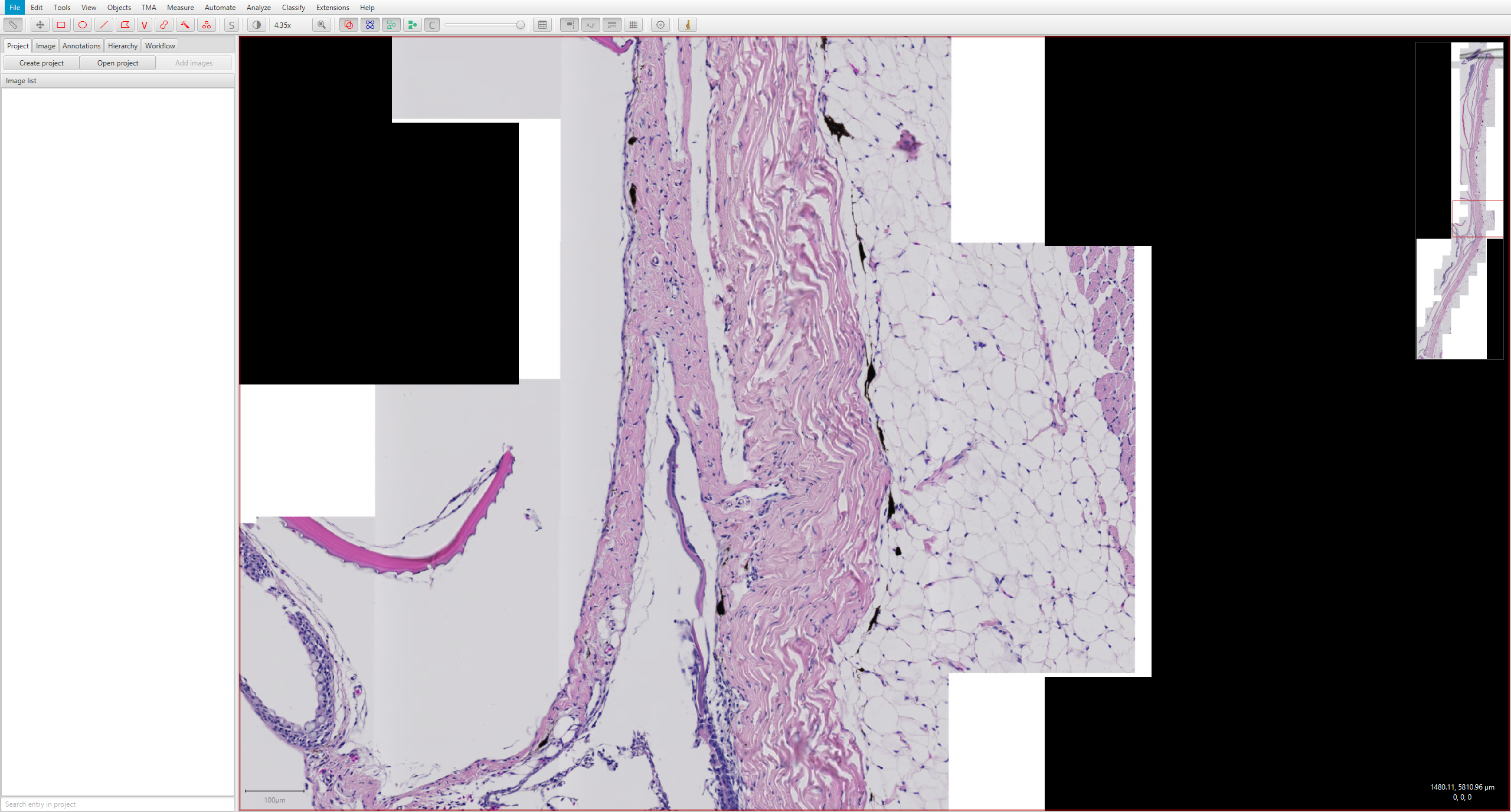 czi file opens at low resolution · Issue #1023 · qupath/qupath · GitHub