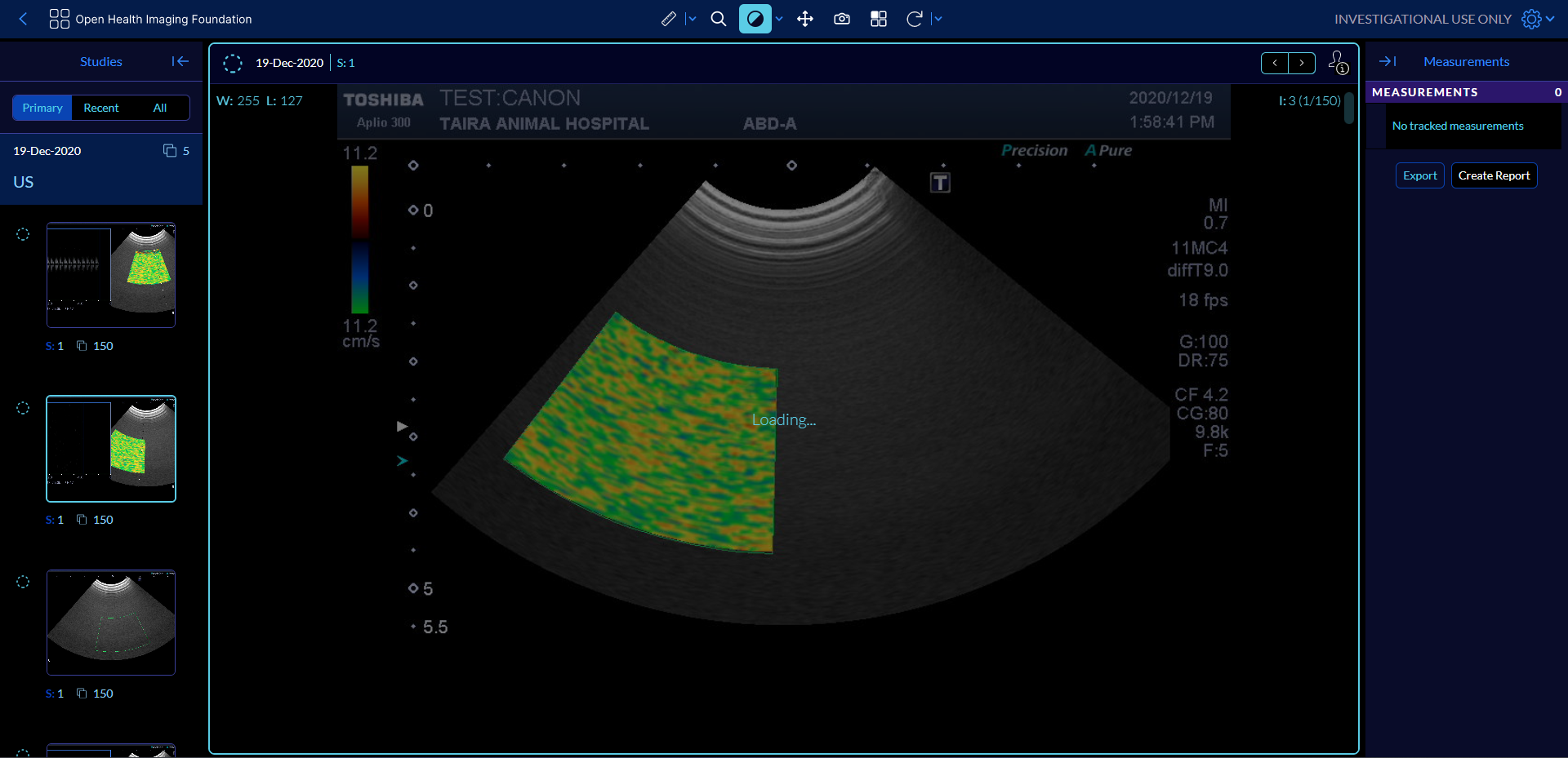 How to speed up loading time of US movie ? · Issue 2991 · OHIF/Viewers