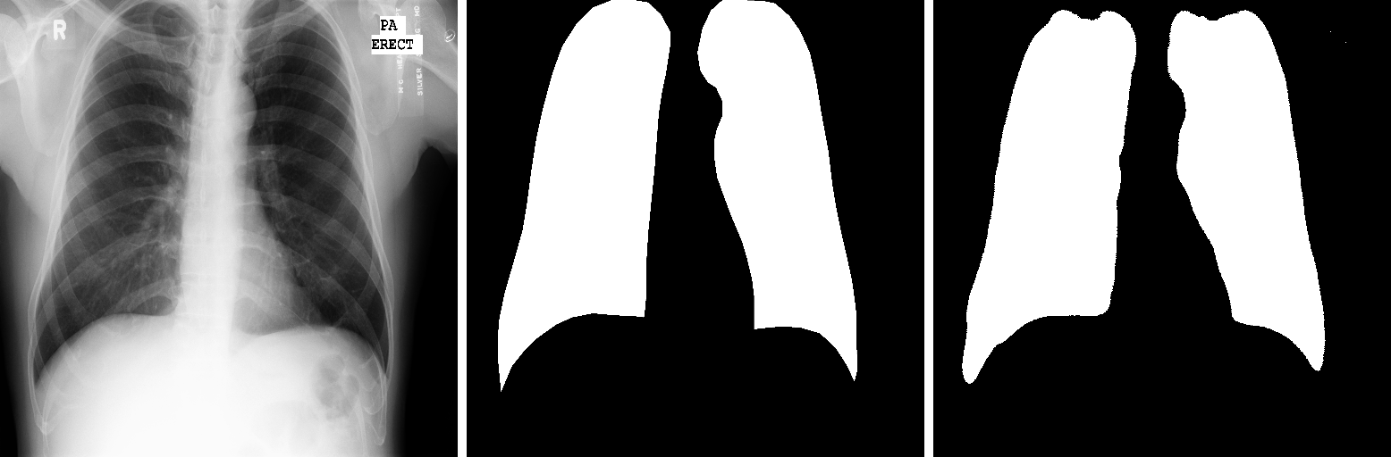 GitHub - bensalahhoussam/lung_segmentation