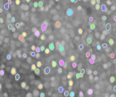 Cannot select all possible cells. · Issue #75 · MouseLand/cellpose · GitHub