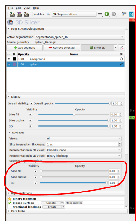 Strange behaviour of Segment Editor in MONAI Label · Issue #780 ...