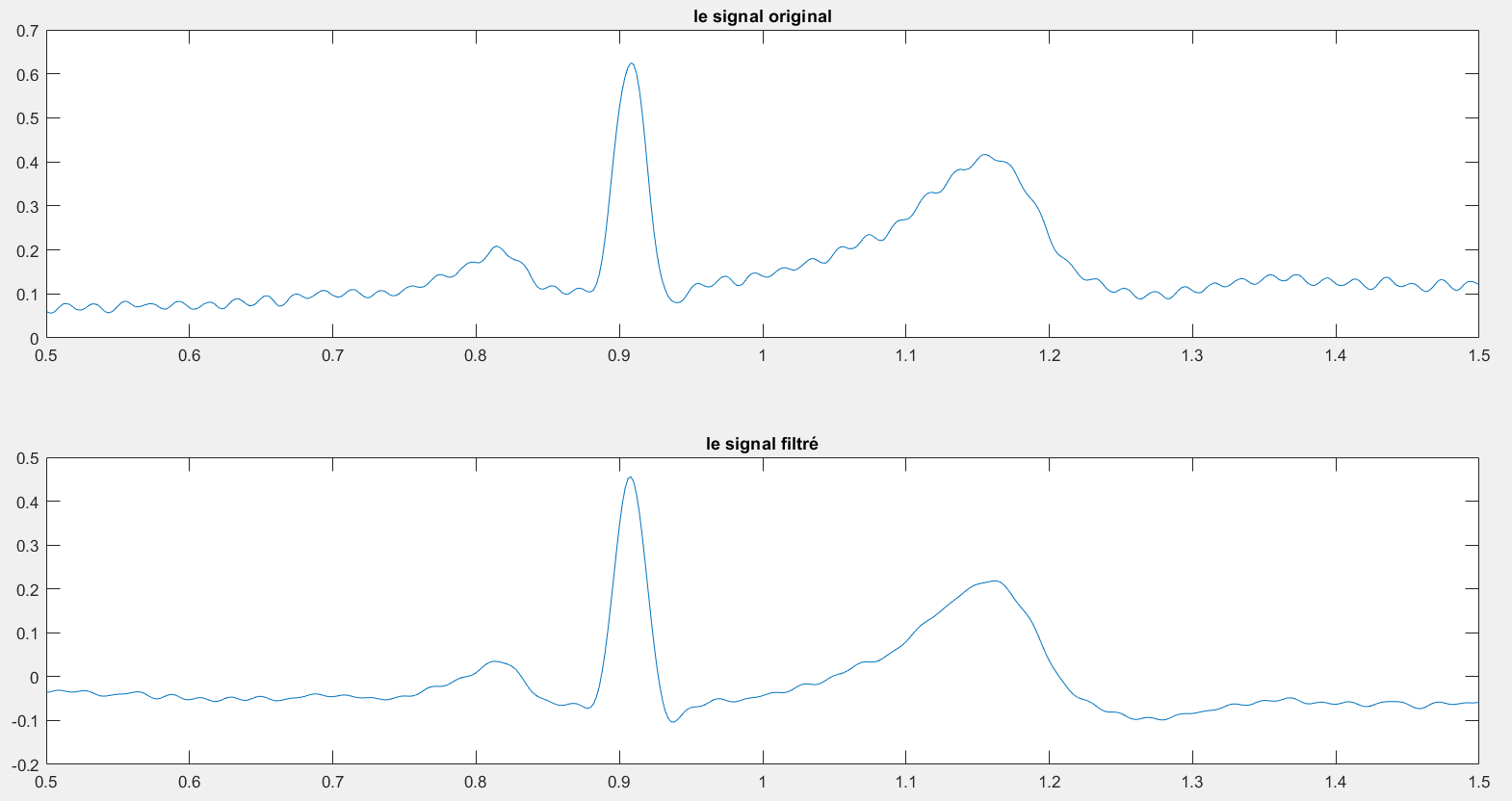 Signal ETB Sensitivity Soft main image 0