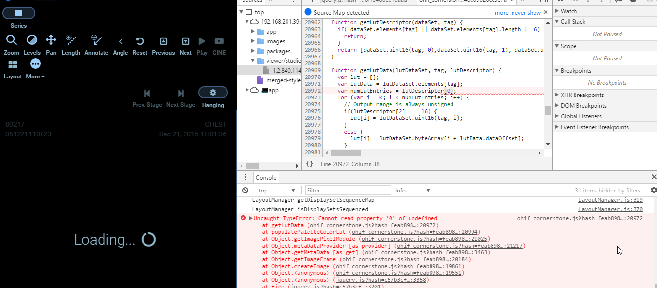 OHIF: Cannot view CR image · Issue #89 · OHIF/Viewers · GitHub
