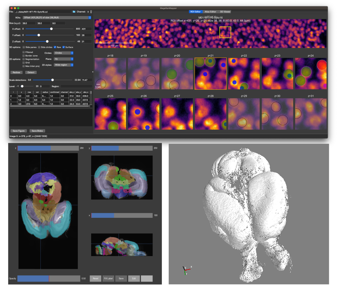 ROI Editor and Atlas Editor screenshots