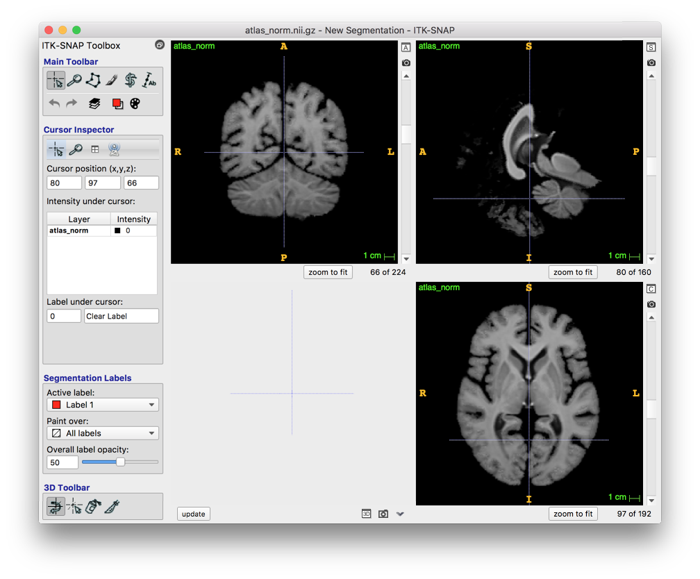 Atlas Orientation? · Issue #58 · voxelmorph/voxelmorph · GitHub