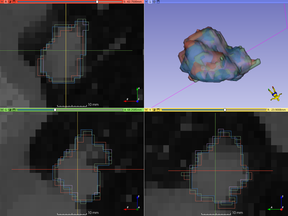 Support different default interpolation for LabelMaps · Issue 782