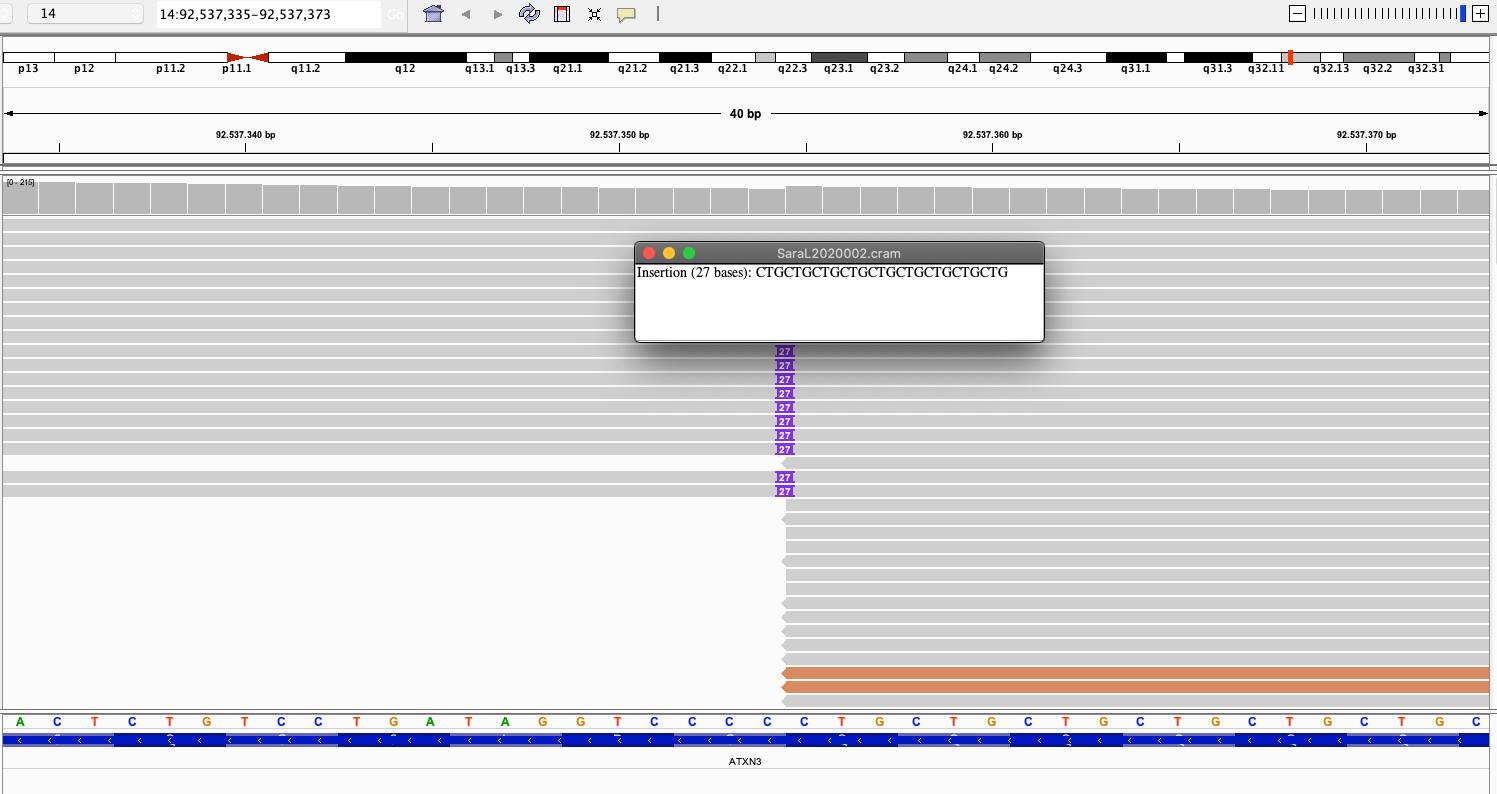 Search a position · Issue #1219 · igvteam/igv.js · GitHub