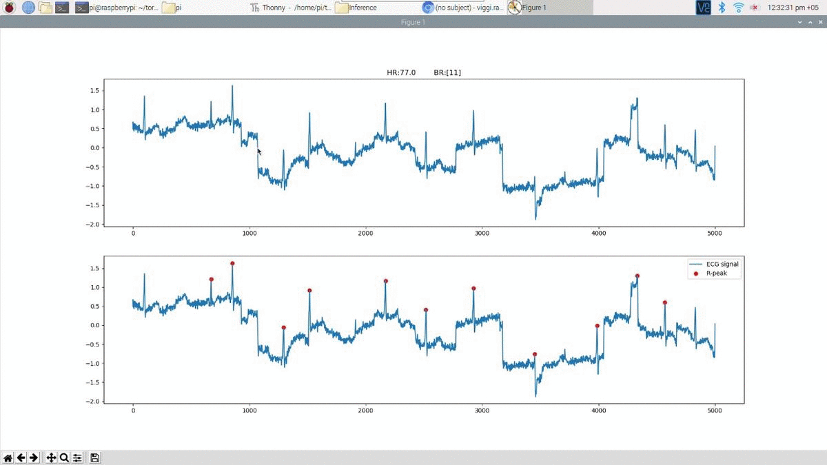 real-time inference for heartbeat, breathing detection