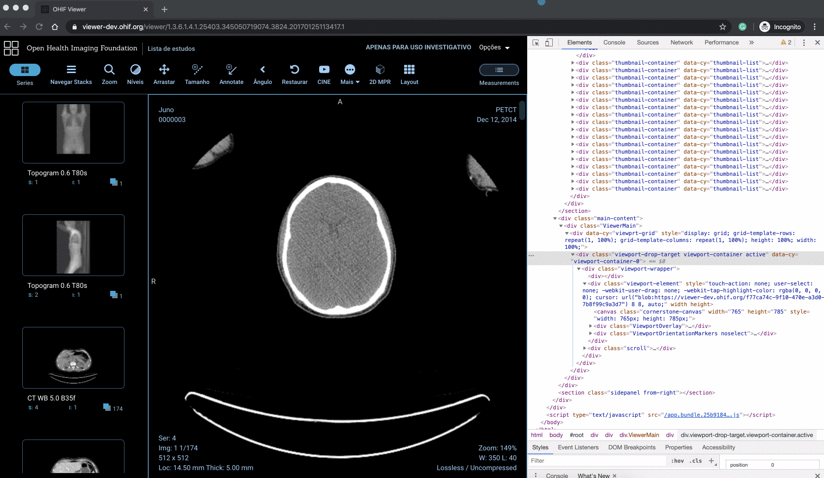 VTK toolbar issues · Issue #1326 · OHIF/Viewers · GitHub