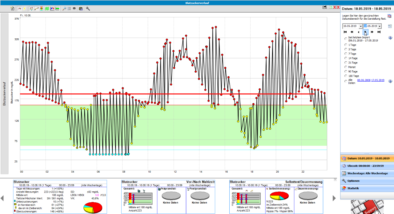 Strange Sensor Strange sensor behavior (Libre, Dexcom G6) showing large oscillations ...