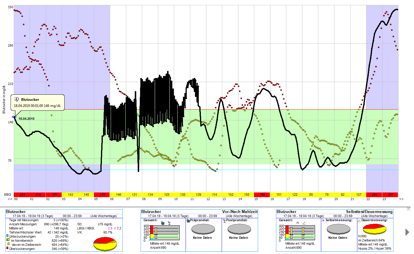 Strange Sensor Strange sensor behavior (Libre, Dexcom G6) showing large oscillations ...