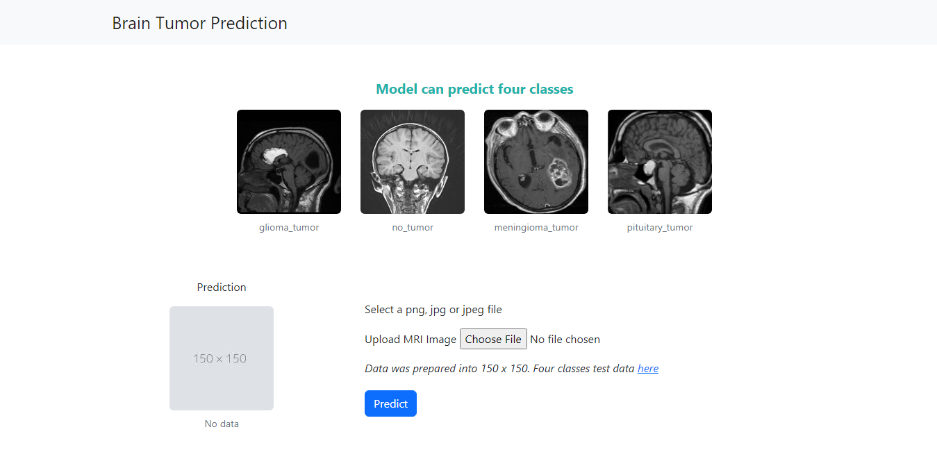 GitHub - IMSoley/PredBrainTumor: A deep learning model for predicting ...