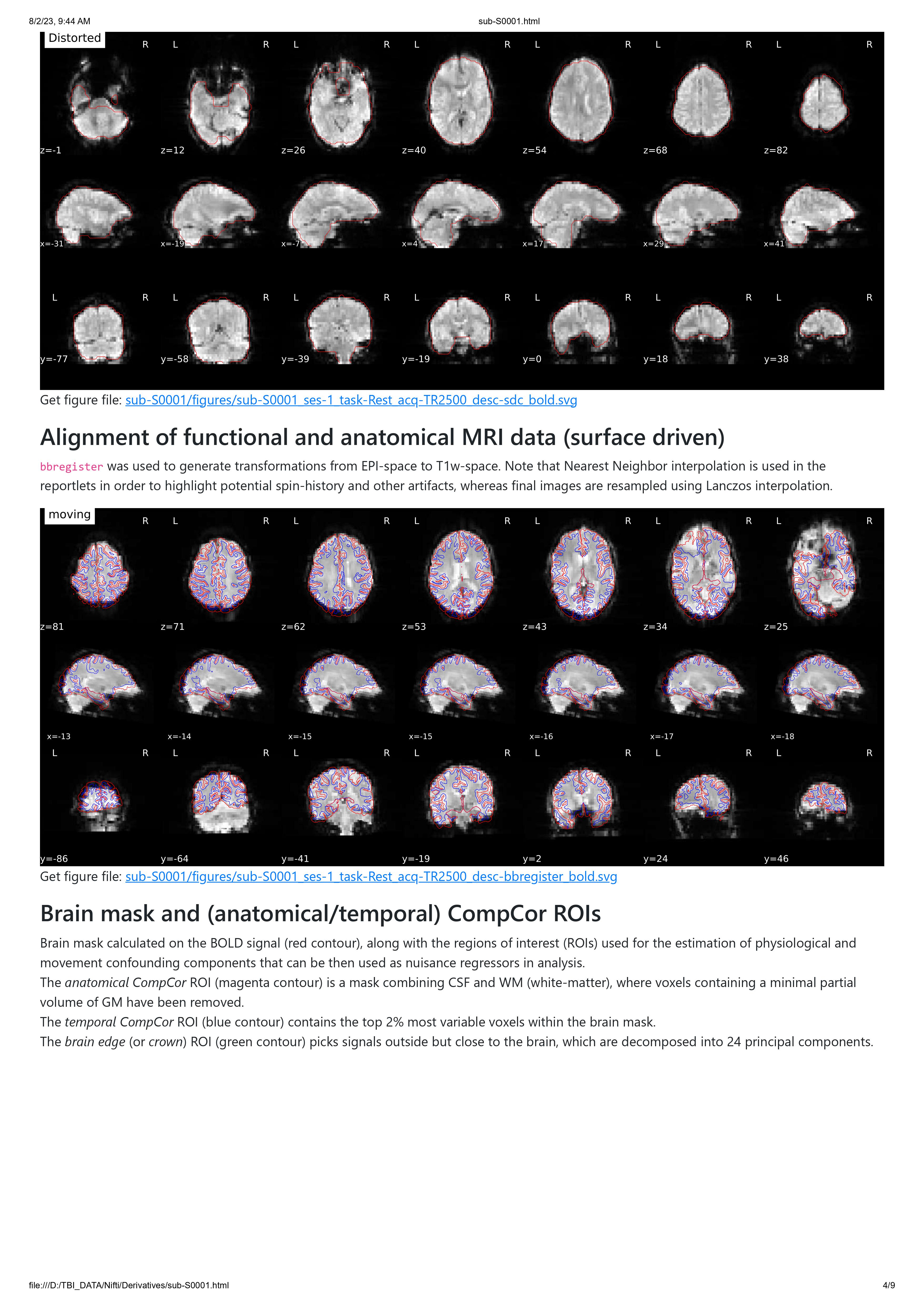 fmriprep-on-tbi-data-issue-3065-nipreps-fmriprep-github