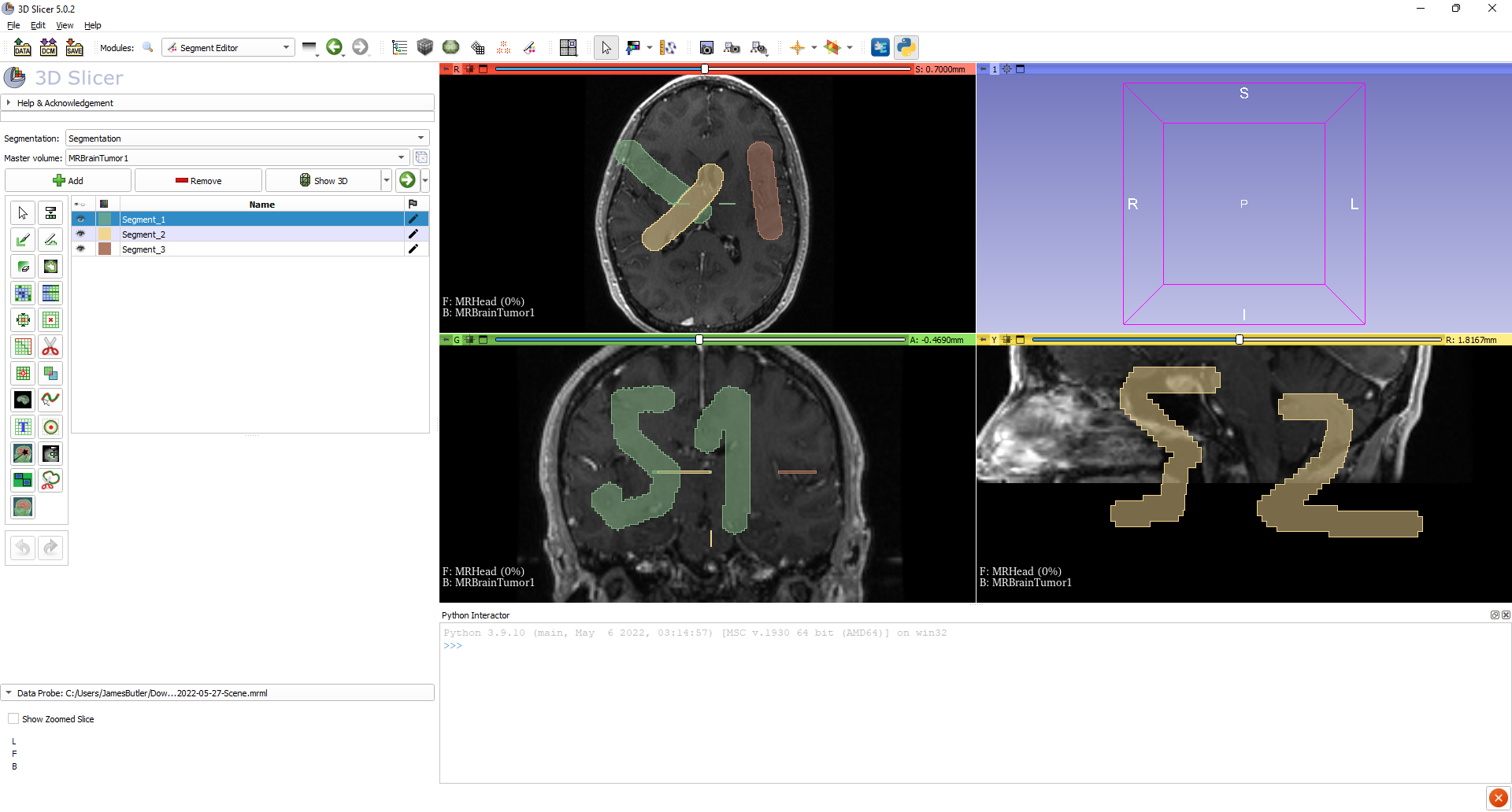 ENH: Optimize processing Segment Editor updates during Batch Processing ...