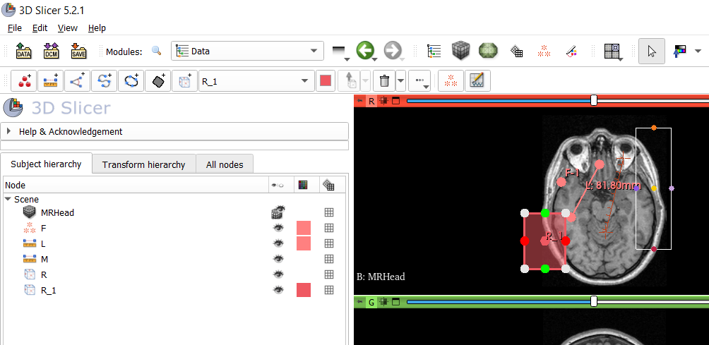 Remove annotations module by lassoan · Pull Request #6524 · Slicer ...