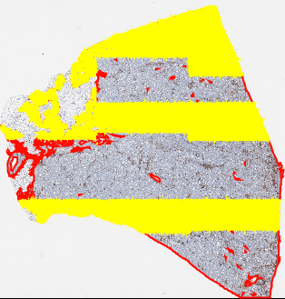 Tiles to annotations bug in .svs file · Issue #115 · qupath/qupath · GitHub