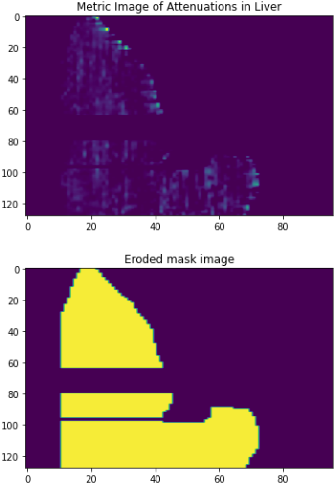 Threading issue in Attenuation filter with TBB MultiThreader · Issue