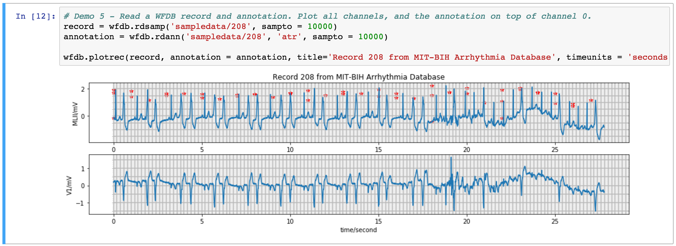 Annotations not showing? · Issue #78 · MIT-LCP/wfdb-python · GitHub
