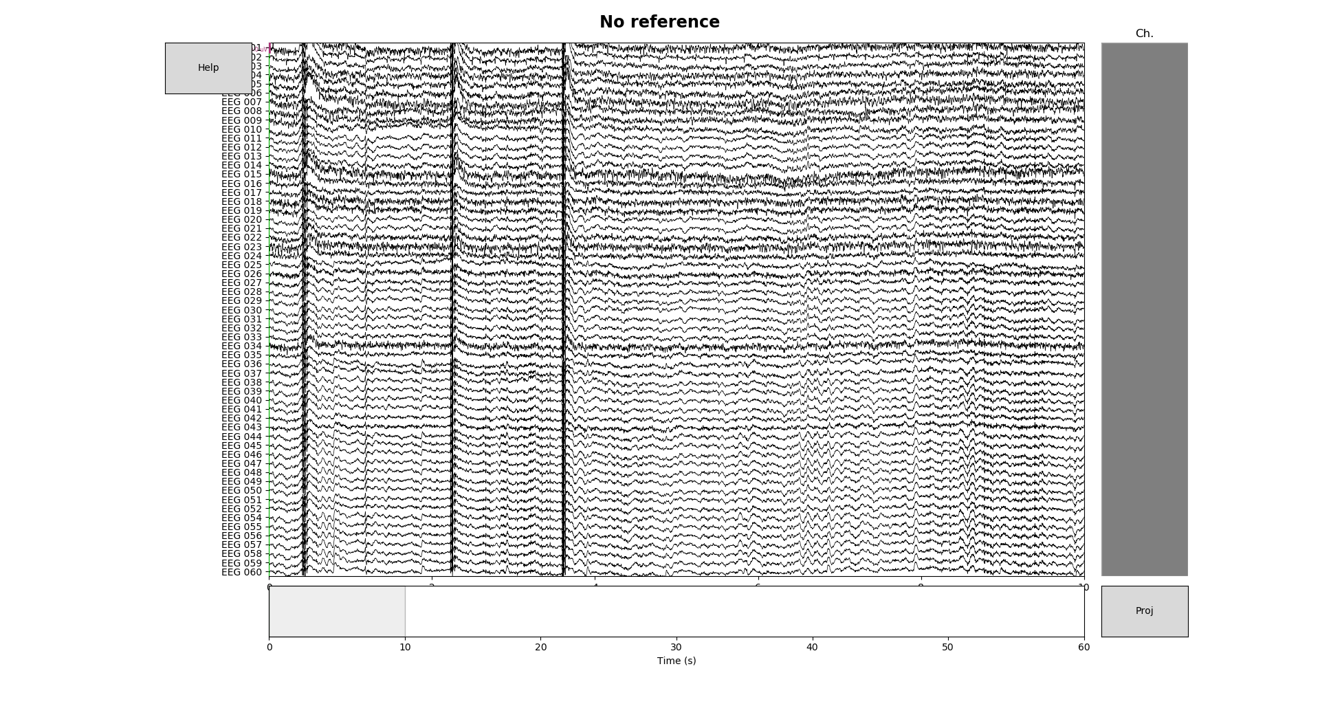 sphx_glr_plot_55_setting_eeg_reference_001