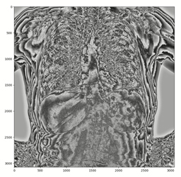 Incorrect dicom reading · Issue #1795 · SimpleITK/SimpleITK · GitHub