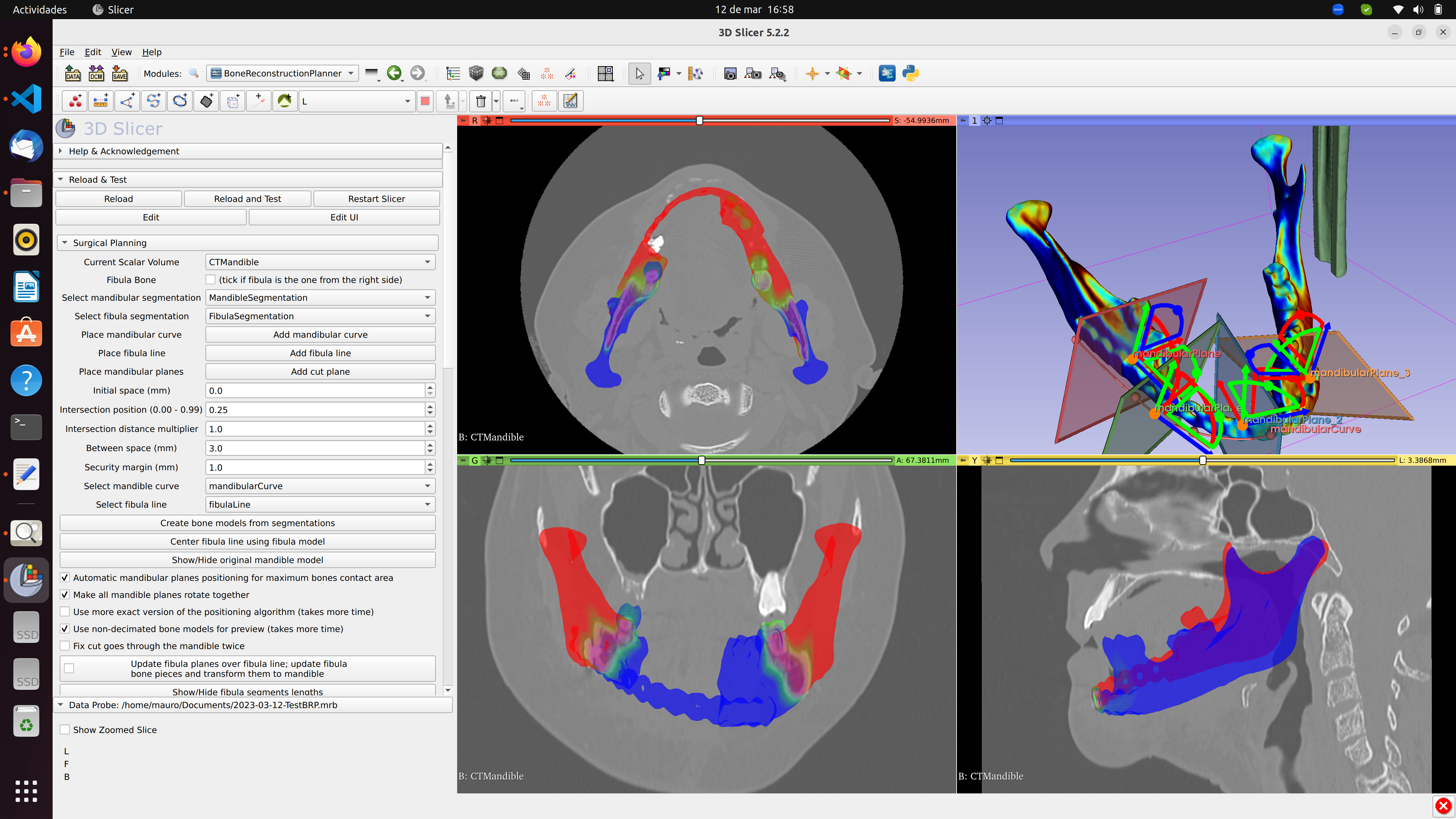 Captura desde 2023-03-12 16-58-32