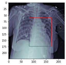 PNEUIMAGE