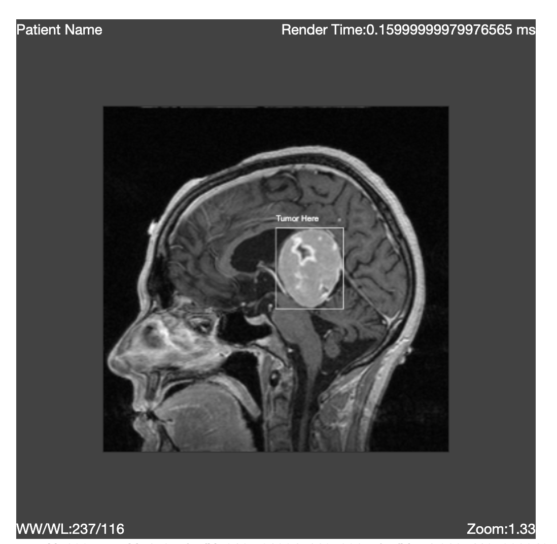 Add a feature to customize canvas fillStyle · Issue 414