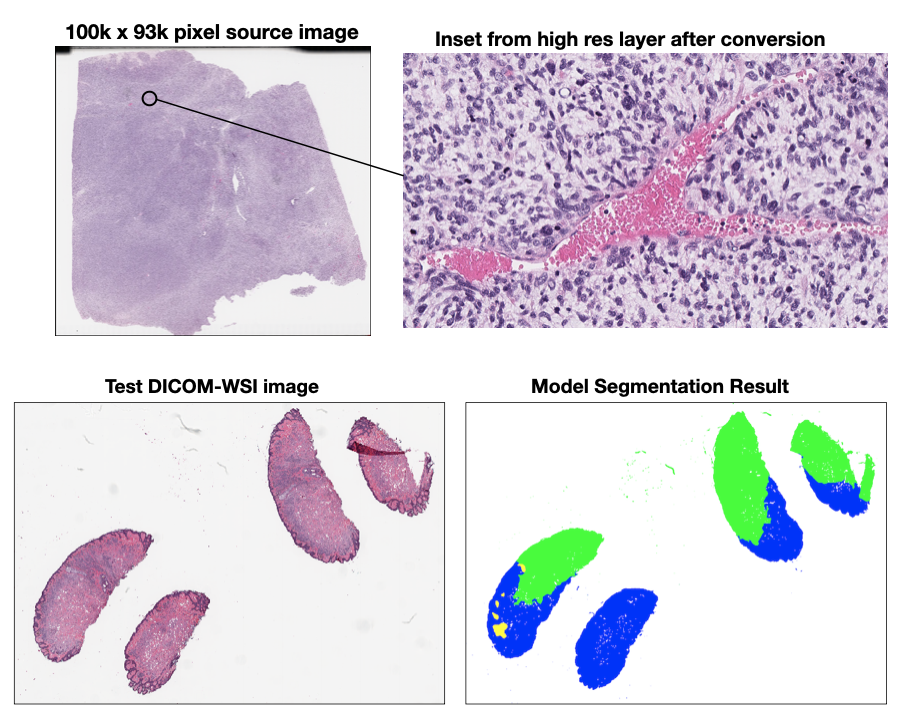 pw38-dicom-wsi-conversion-and-model