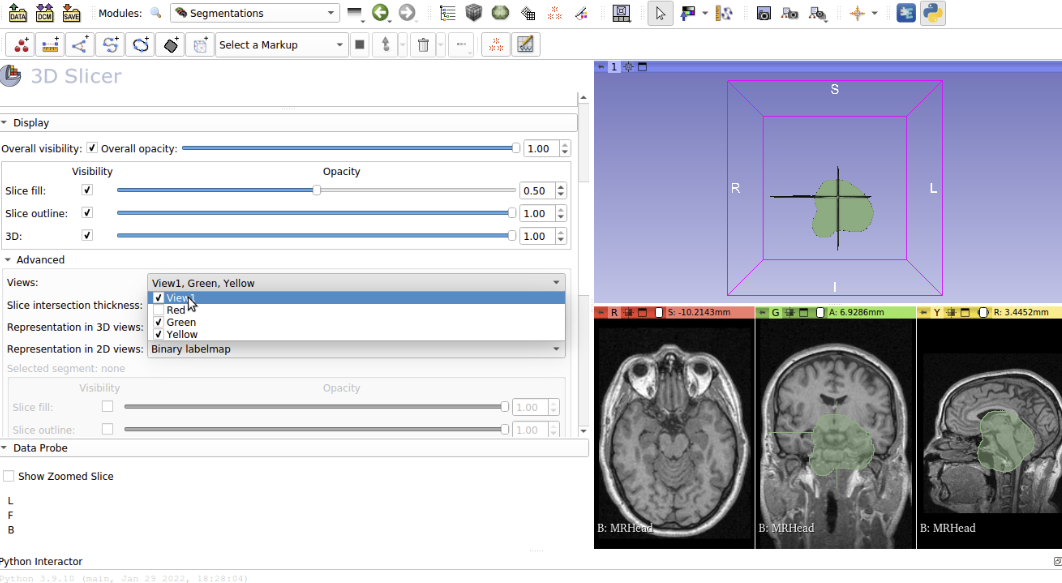 github kitwaremedical Images High Quality Grahic Separate xray views · Issue #3 · KitwareMedical/lungair-desktop ...