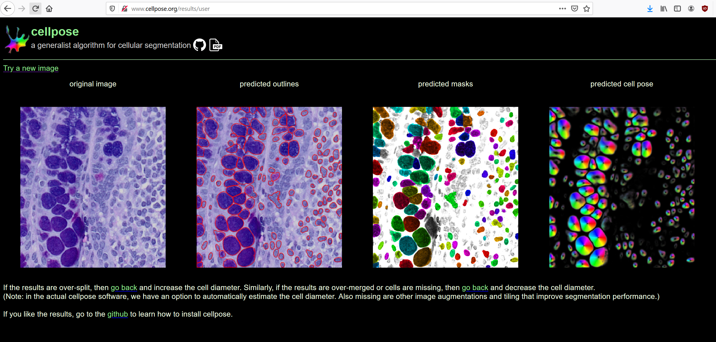 inverting the image intensity as a preprocessing step · Issue #26 ...