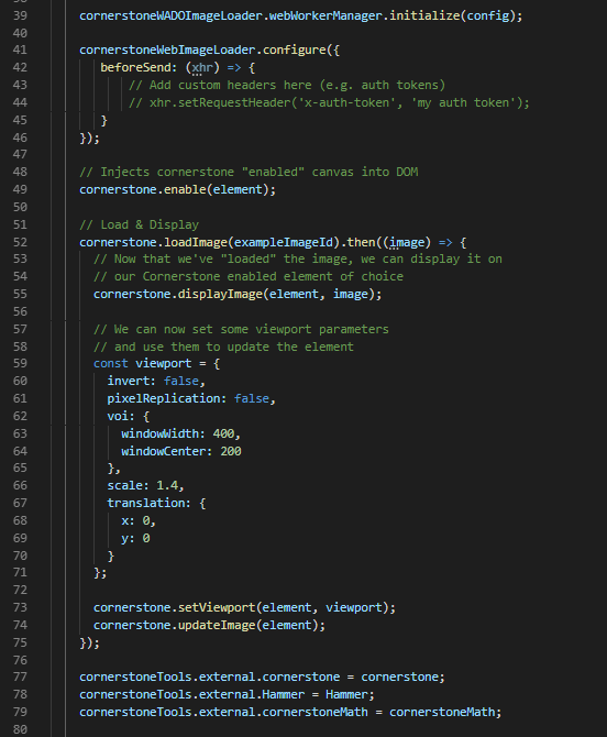 Tools not working in Angular 8 · Issue 1149 · cornerstonejs