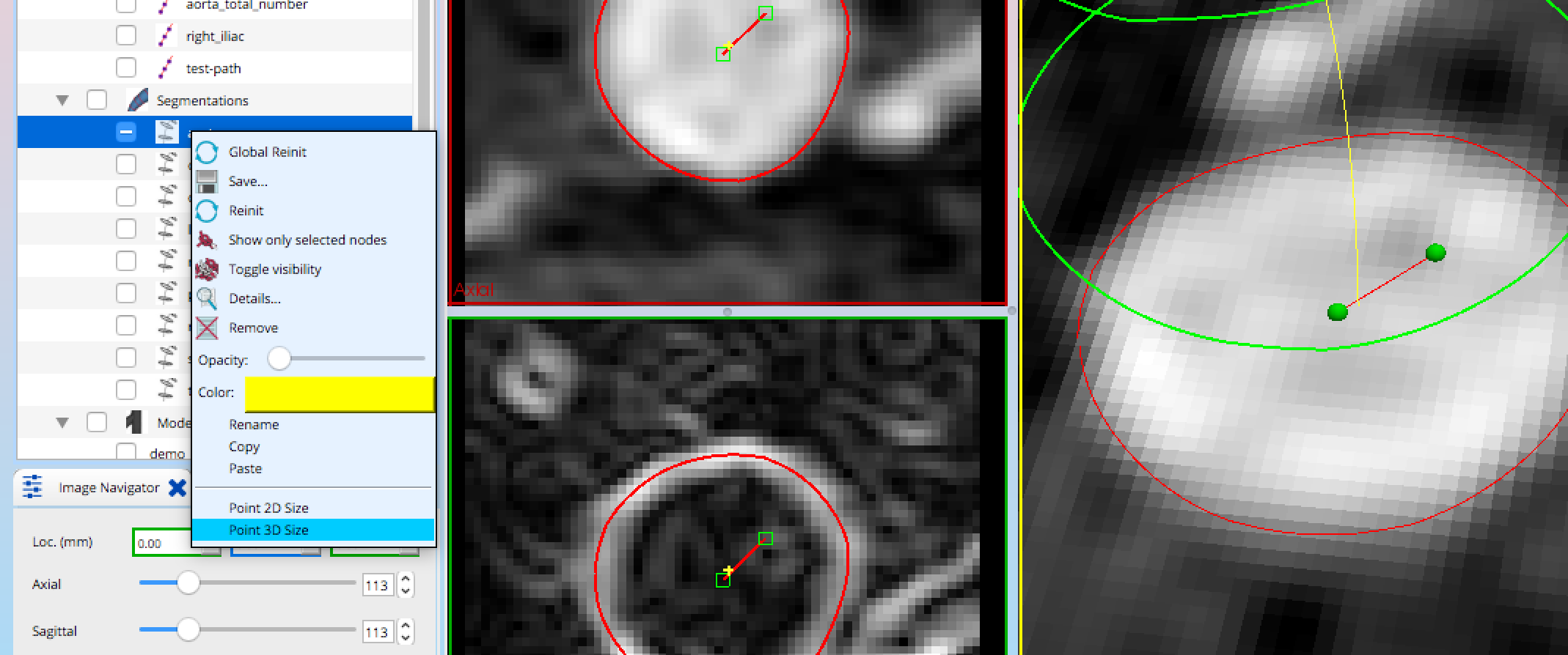Segmentation Object Scaling Issues Issue 699 SimVascular segmentation-object-scaling-issues-issue-699-simvascular