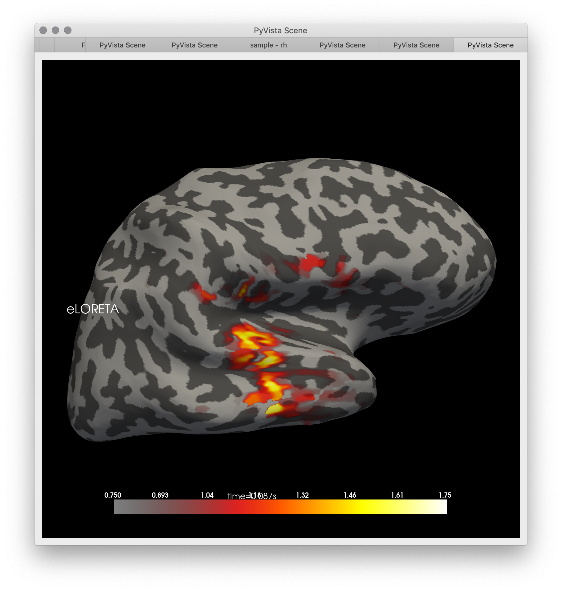 Screen Shot 2019-10-03 at 11 38 37