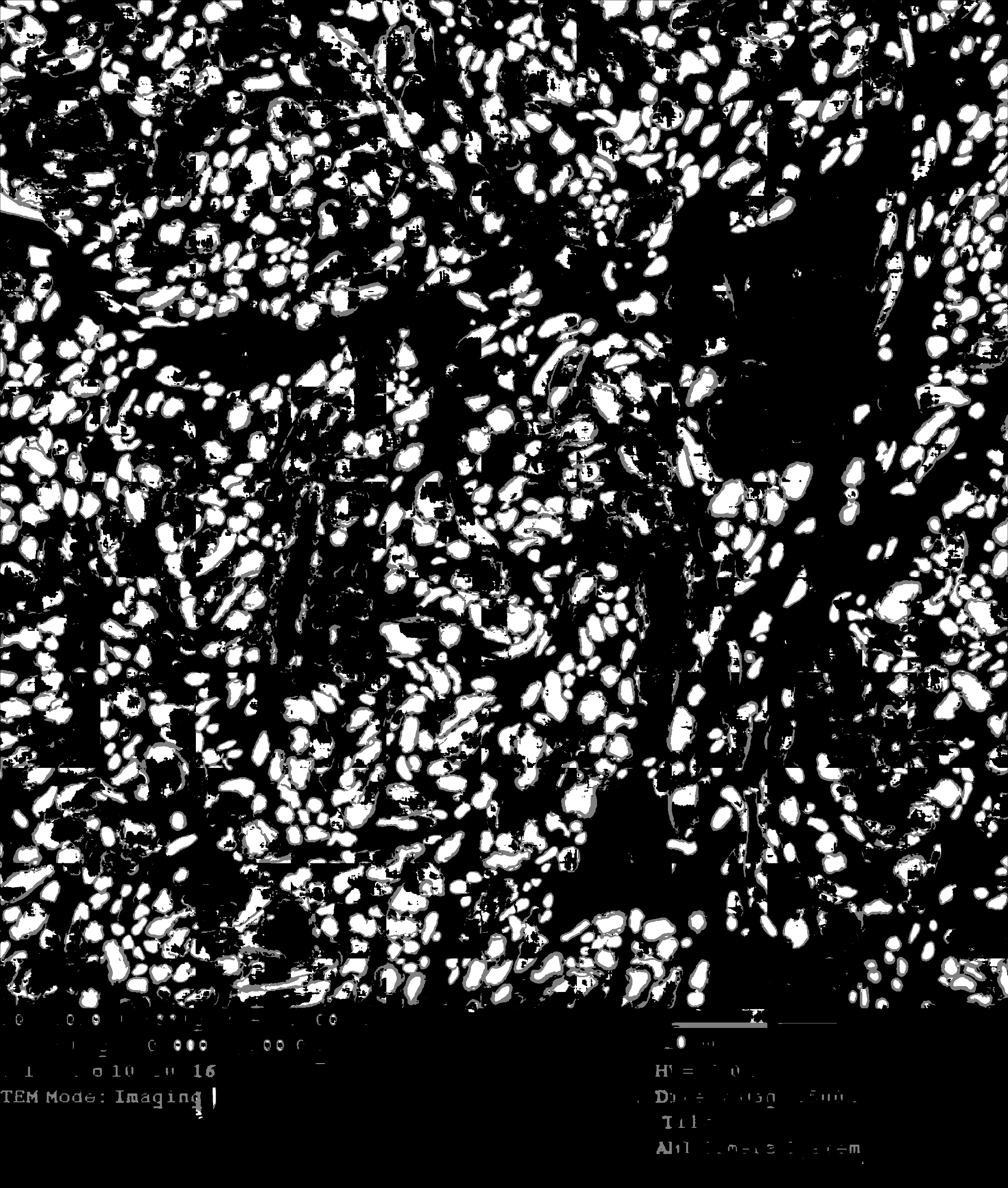Poor segmentation results on large field TEM · Issue #55 · axondeepseg ...