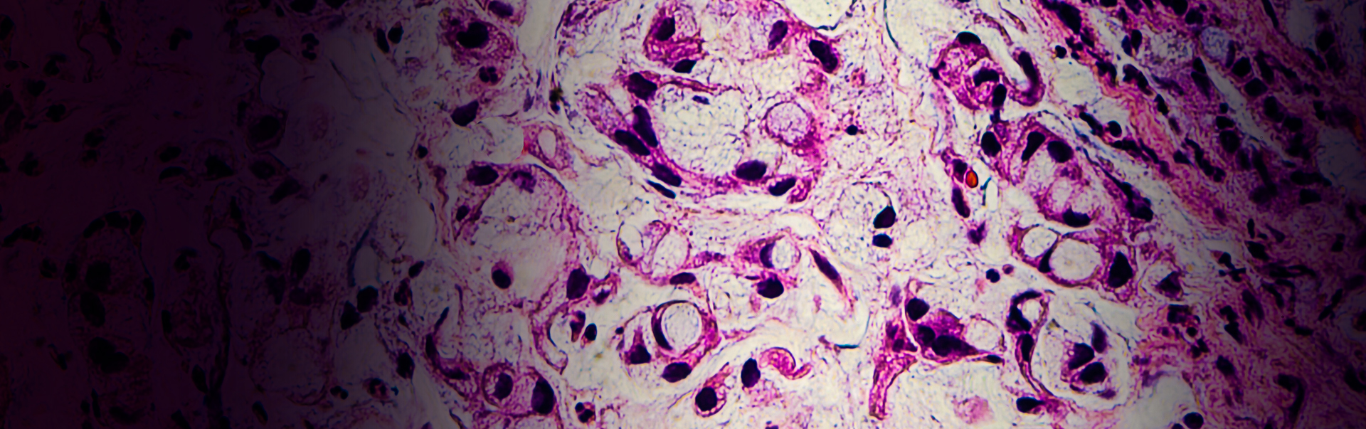 My Mum has cancer. Coping is tough