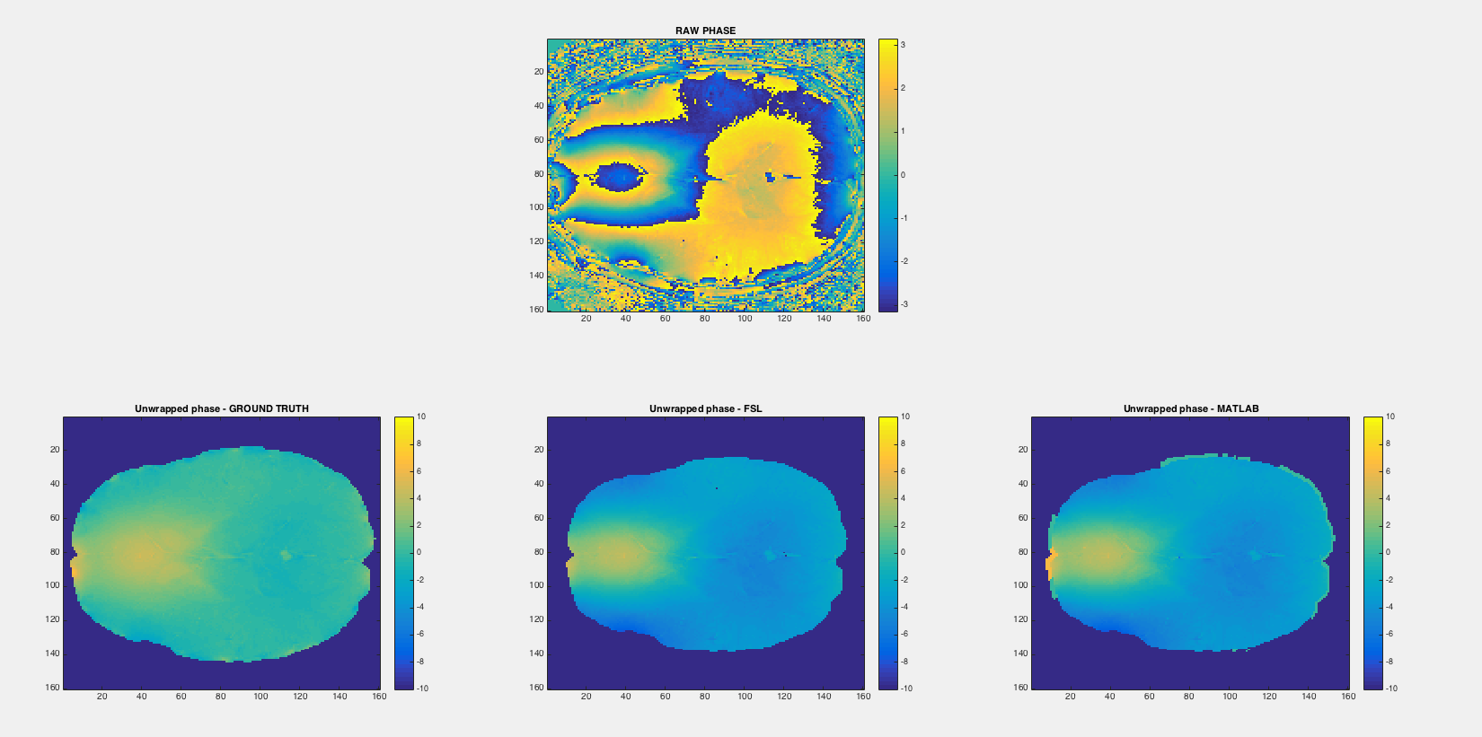 B0 mapping Phase unwrapping · Issue 48 · qMRLab/qMRLab · GitHub