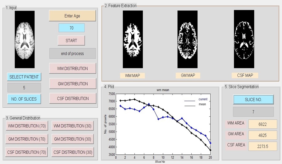GitHub - shubhamjiwtode/MRI_segmentation