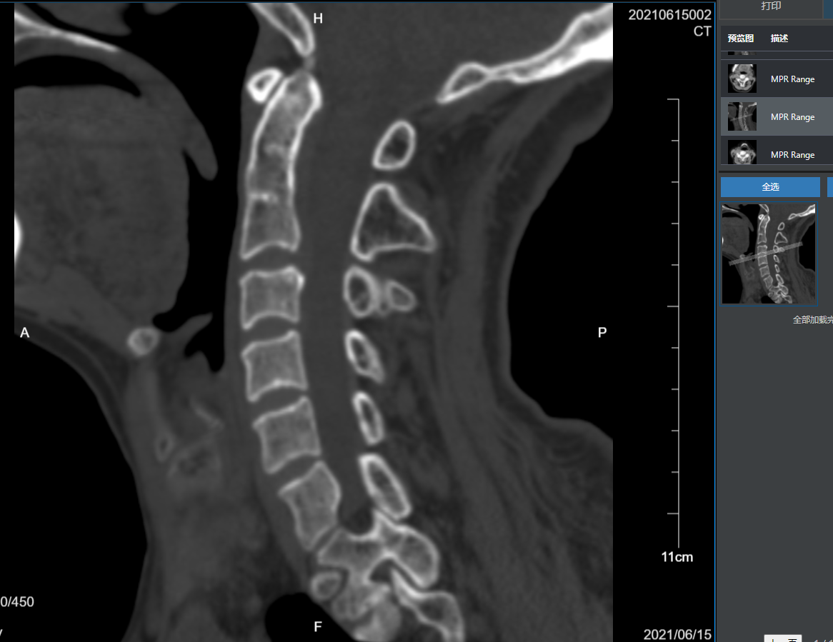Dicom Reference Line My DICOM file doesn't show the location mark area of the ReferenceLines ...