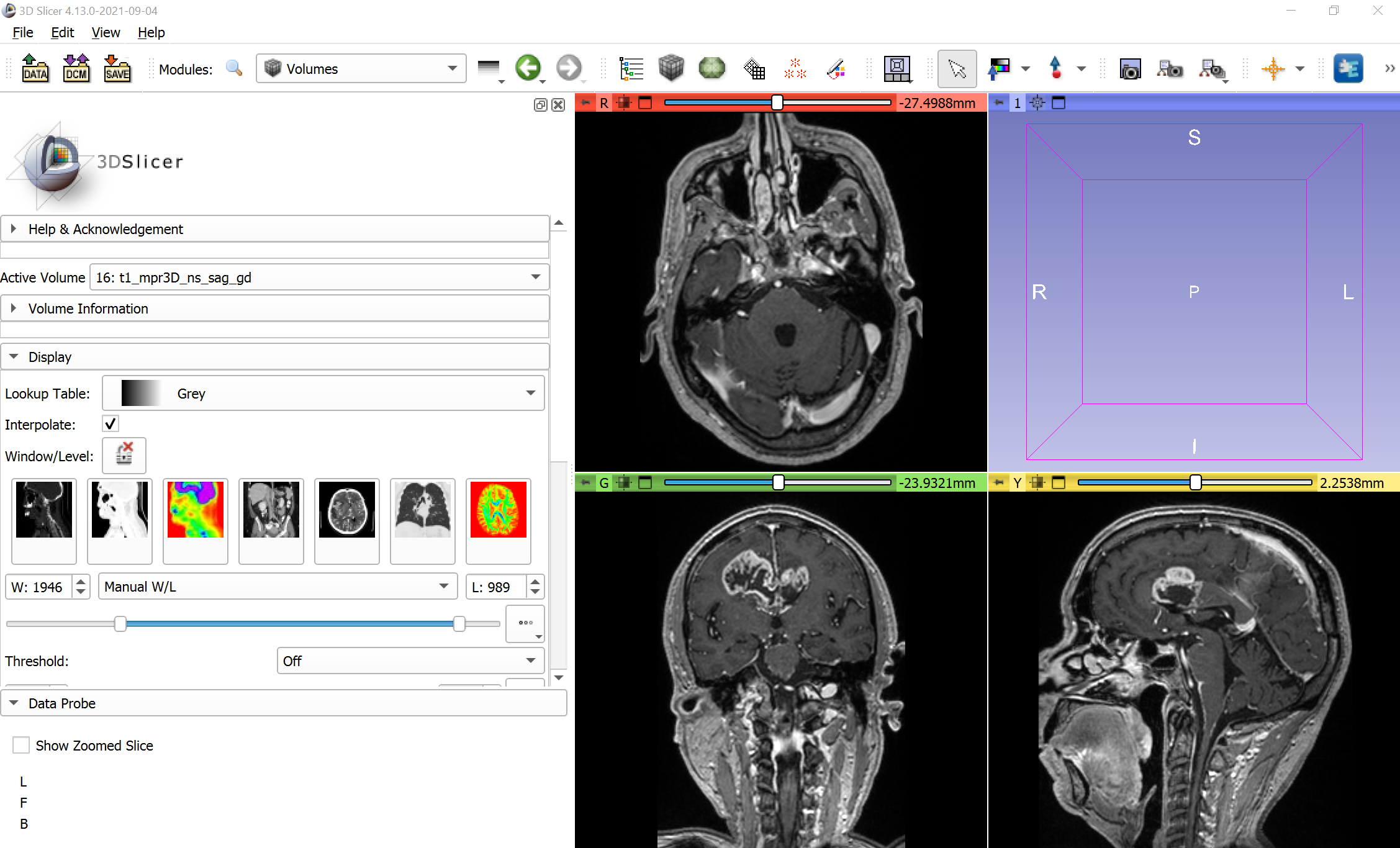 Slice Location Dicom – DICOM Viewer – POIZ