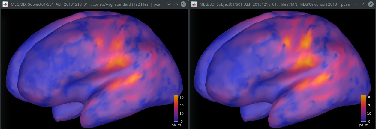 Flattening_160ms_20220919