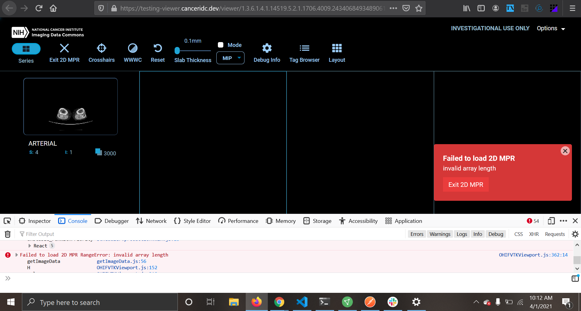 Buffer allocation failure trying to do MPR for a large series · Issue ...