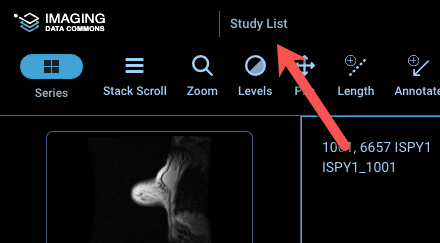 "Study list" should be disabled for OHIF Viewer · Issue #164 ...