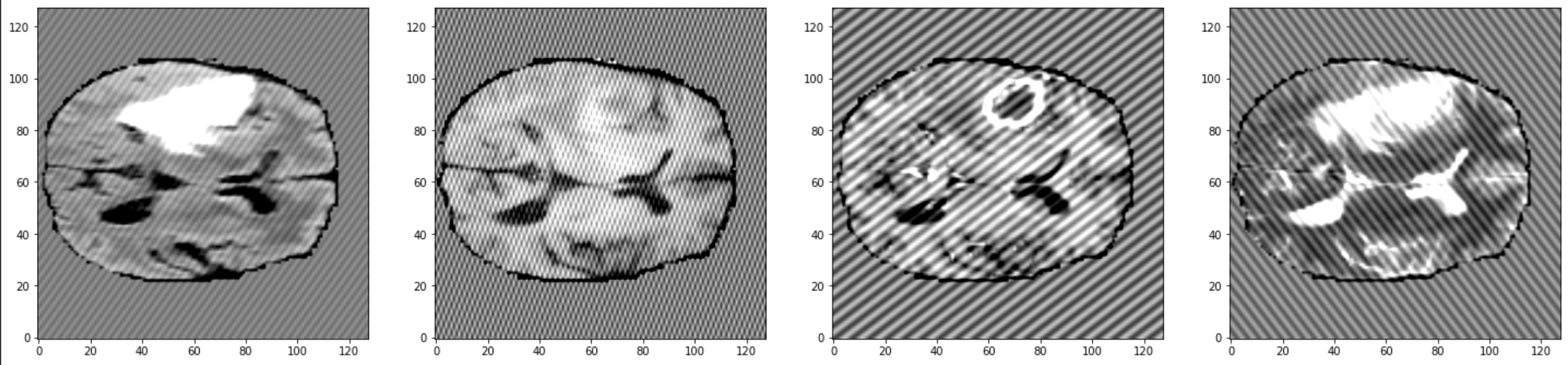 Spike (Herringbone) artifact transform by yanielc · Pull Request 2337