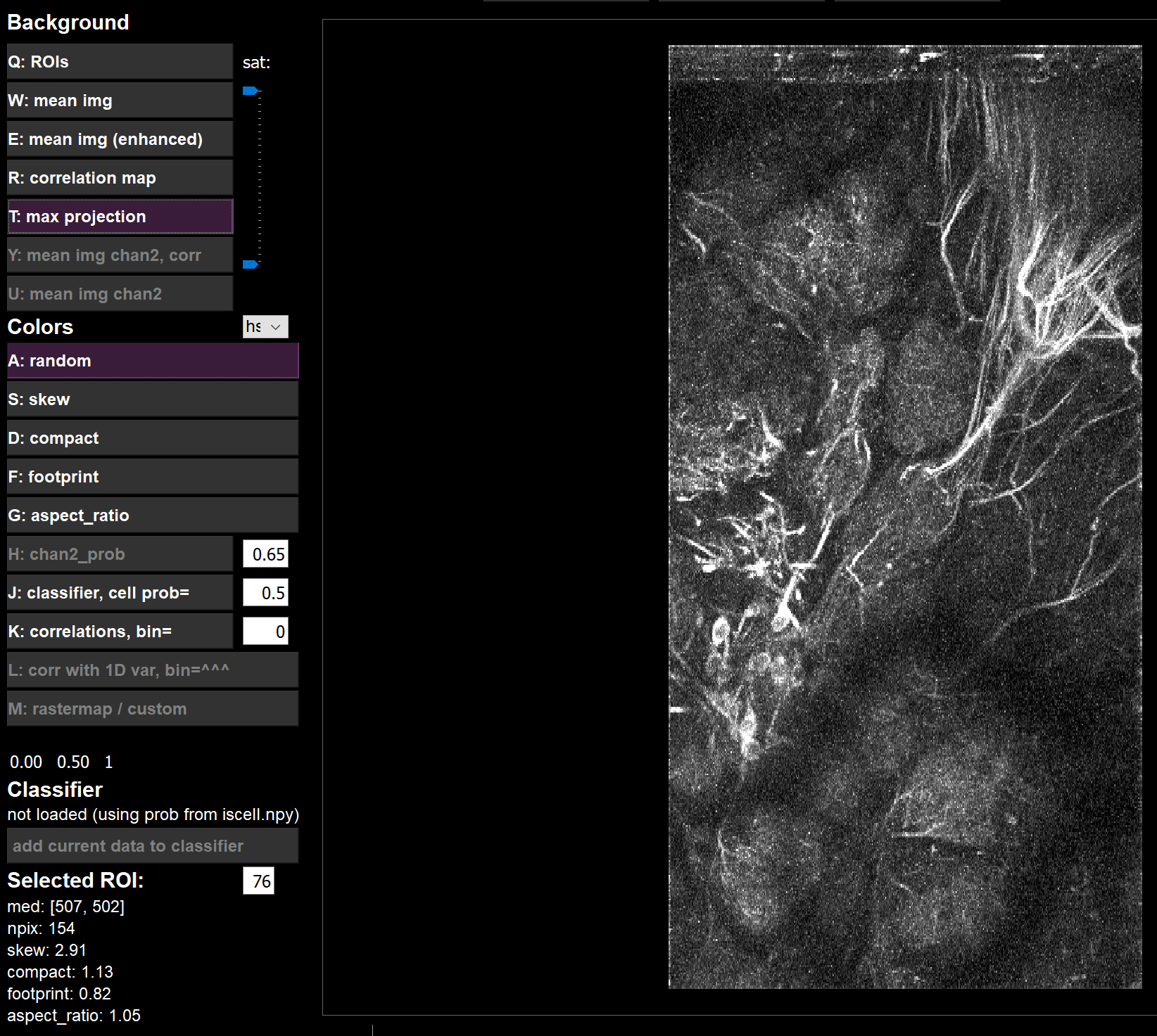 detectTC_test03_maxProj