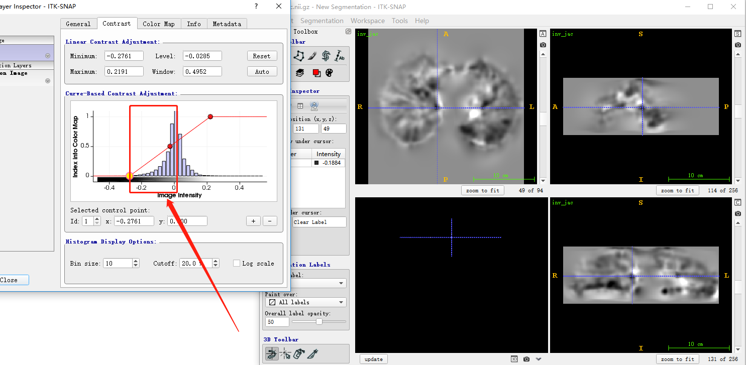 Maybe I got a fold that is close to half · Issue #829 · ANTsX/ANTs · GitHub