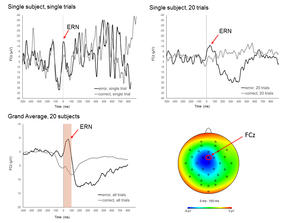 GitHub - newstar1993/EEG-data-analysis: Analysis of EEG Dataset · GitHub