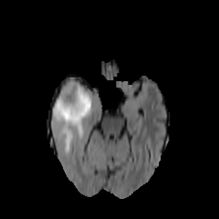 issues warning io inconsistently contrast low scikit