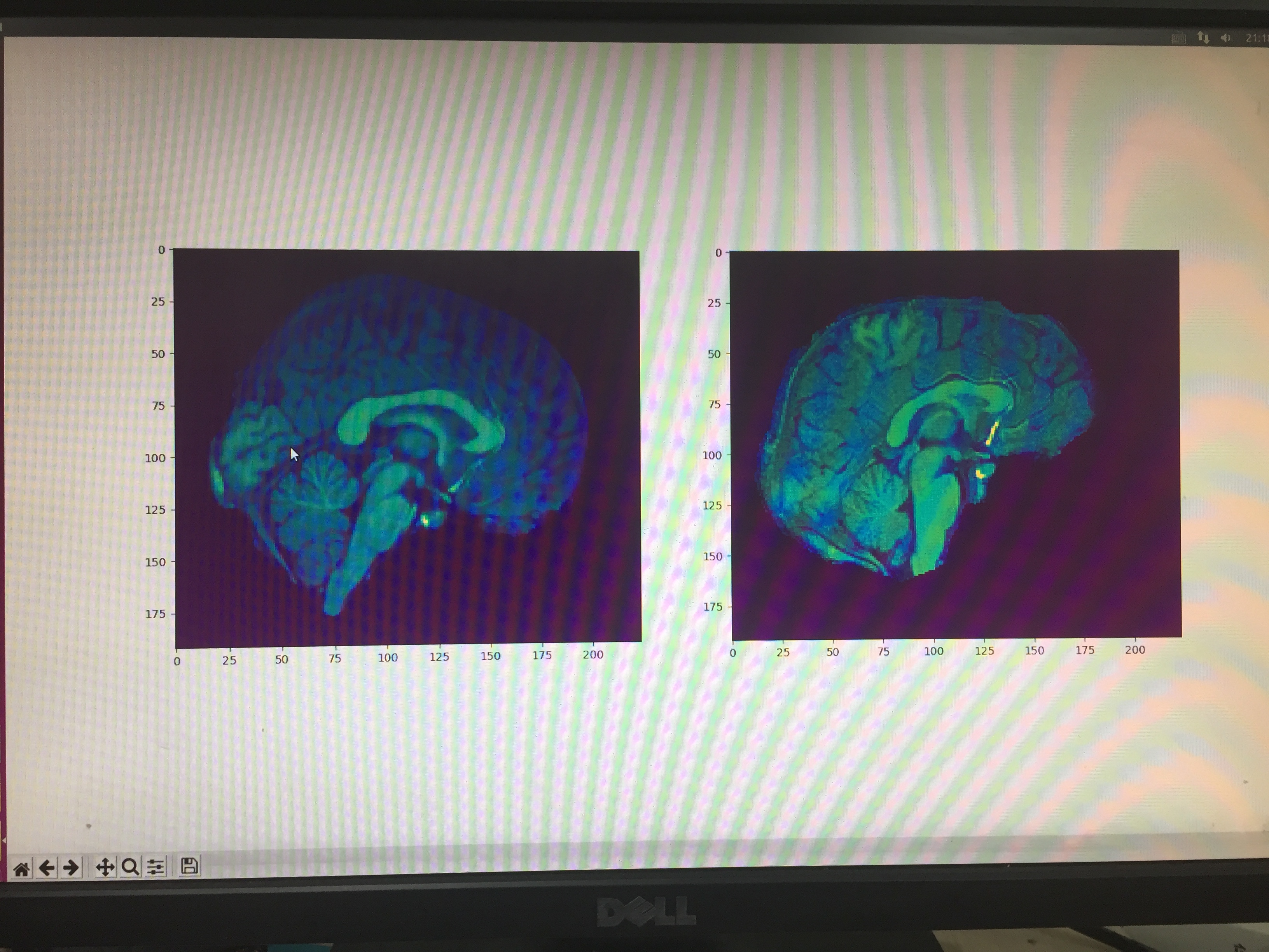test_seg.npz · Issue #15 · voxelmorph/voxelmorph · GitHub